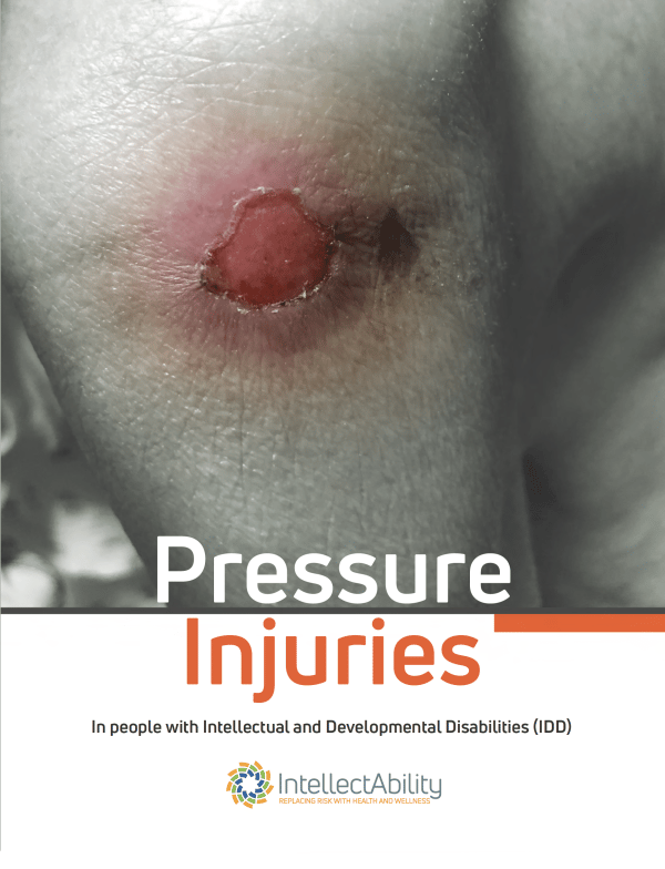 Pressure Injuries in People with IDD